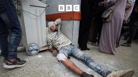 Global News Podcast, Patterns of injury in a Gaza war hospital