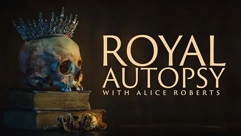 Royal Autopsy with Alice Roberts