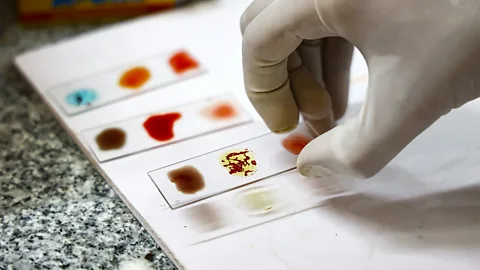 A gloved hand holds a glass slide with blood samples on it (Credit: Getty Images)