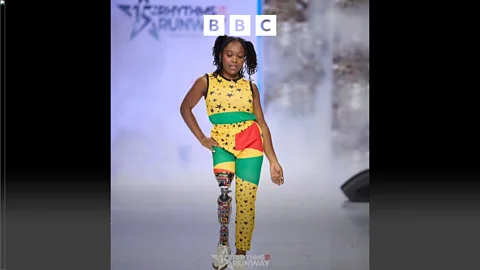 Global News Podcast, The Happy Pod: The model redefining beauty norms