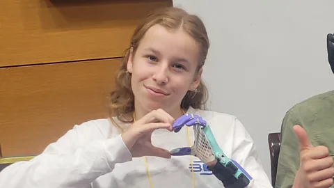 Global News Podcast, The Happy Pod: My friends made me a new hand