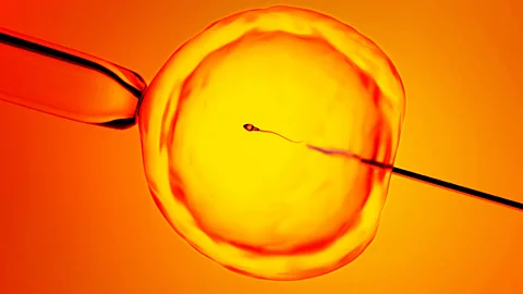 Illustration of a sperm cell being injected into an egg during in vitro fertilisation (Credit: Getty Images)