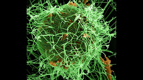 Global News Podcast, What we know about latest Ebola outbreak