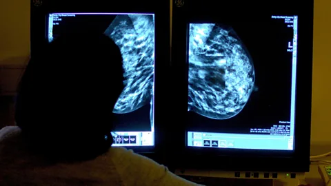 Global News Podcast, The Happy Pod: Kinder medicine for millions of cancer patients