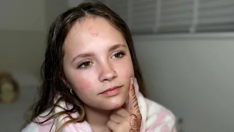 The Global Story, The Global Story, The kid-fluencers selling younger looking skin