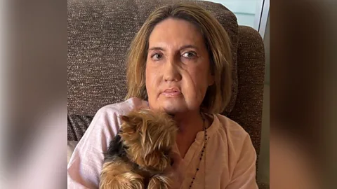 The Documentary Podcast, Euthanasia in Spain: Whose life is it anyway?