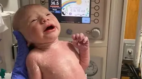 Global News Podcast, The Happy Pod: The baby saved by surgery in the womb