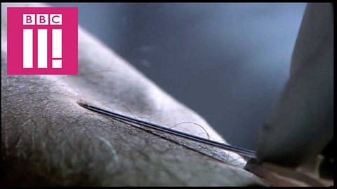 How does a lethal injection work?