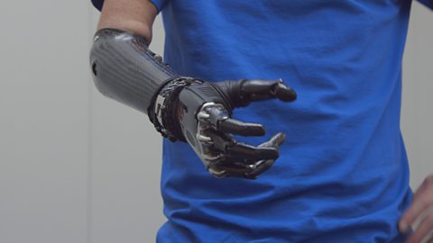 Amazing Humans: Cybathlon