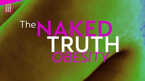 The Naked Truth about obesity
