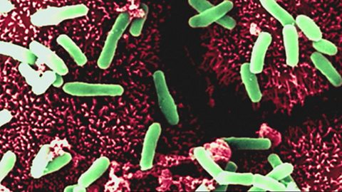 Microorganisms and bacteria