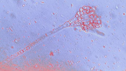 A microscoped image of penicillin damaging a bacterial cell