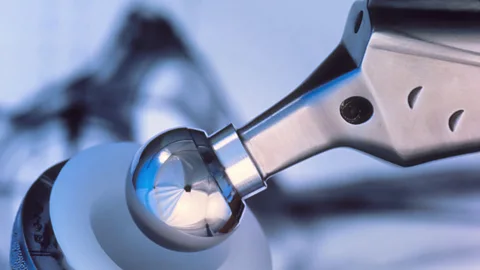 The metal in hip replacements can be recycled post-cremation - some may even end up used in a car or plane. (Science Photo Library)