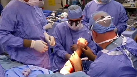 It took 12 surgeons to attach the new hands (ABC News)