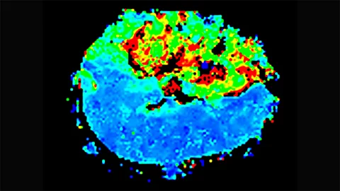 Functional magnetic resonance imaging, or fMRI, measures activity in the brain by detecting changes in blood oxygenation and flow (Science Photo Library)