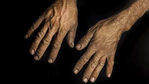 Scientists have made people believe a dark-skinned hand is their own, and found it reduces prejudice (Thinkstock)