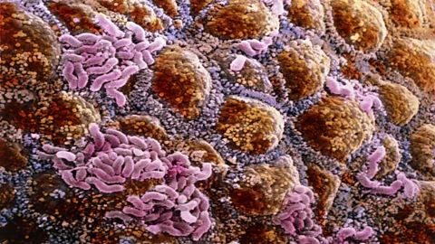 Alterations in the makeup of micro-organisms in the gut may lead to development of autoimmune disease (Science Photo Library)