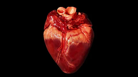 Pig hearts are anatomically similar to ours - just one reason why they make suitable donors (SPL)