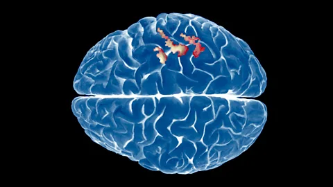 Decoding brain signals from scans can reveal what somebody is looking at (SPL)