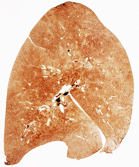 A section through a normal lung    