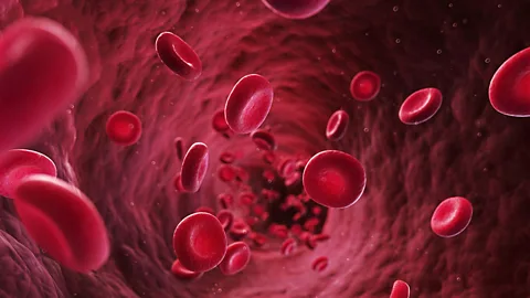 Blood pressure-related injuries to coronary artery walls can contribute to heart disease (Thinkstock)