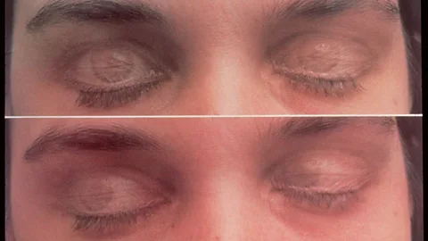 REM sleep can foster creative problem-solving (SPL)