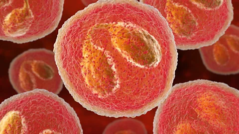 Science Photo Library (Credit: Science Photo Library)