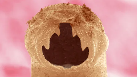 Science Photo Library Do allergic reactions stem from our body’s reactions to parasitic worms? (Credit: Science Photo Library)