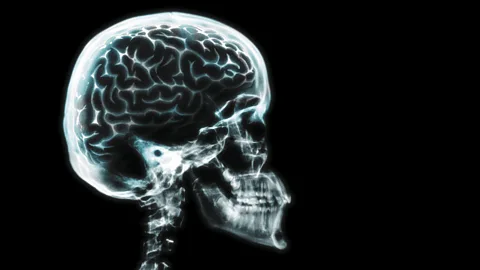 Thinkstock The human brain is advantageously big (Credit: Thinkstock)