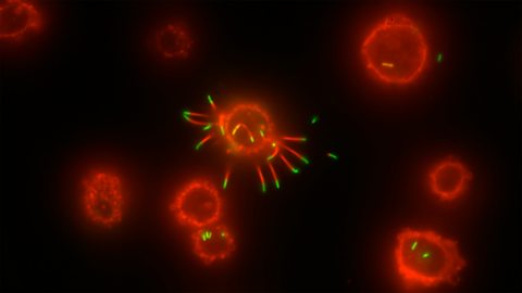 Listeria monocytogenes