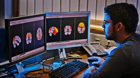 SPL Functional magnetic resonance imaging monitors bloodflow to gauge brain activity (Credit: SPL)