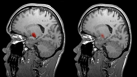 SPL Researchers ask people to perform specific tasks inside fMRI scanners, then monitor the activity to infer what the brain is doing (Credit: SPL)
