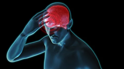 Science Photo Library Migraines may become less severe as we age, research suggests (Credit: Science Photo Library)