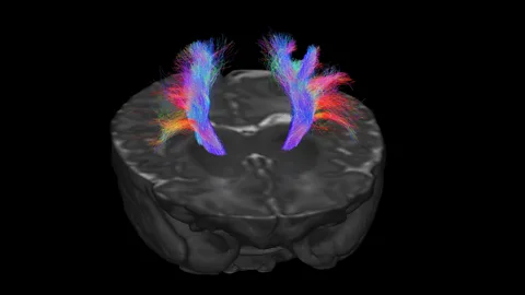 dHCP Connecting the cortex to the spinal cord, this information highway allows us to control movement and feel touch (Credit: dHCP)