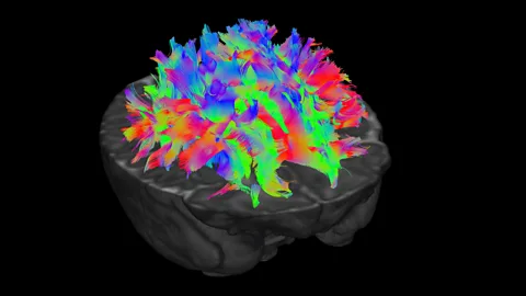 dHCP The different colours represent fibres travelling in different directions, so the scientists can pick apart which pathways connect which parts of the brain (Credit: dHCP)