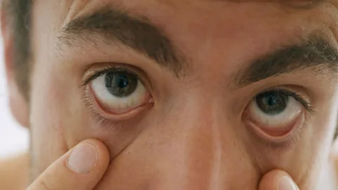 Getty Images (Credit: Getty Images)