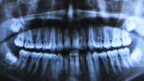 Thinkstock (Credit: Thinkstock)