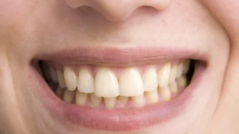 Getty Images Tea’s natural pigments are more likely to adhere to dental enamel than coffee’s, dentists say (Credit: Getty Images)