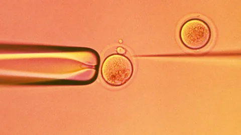 SPL In Israel, state health insurance can fund IVF cycles using sperm extracted without specific written consent (Credit: SPL)