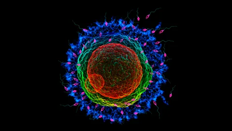 SPL How should doctors and review boards weigh up decisions on fertilisation from post-mortem sperm extraction? (Credit: SPL)