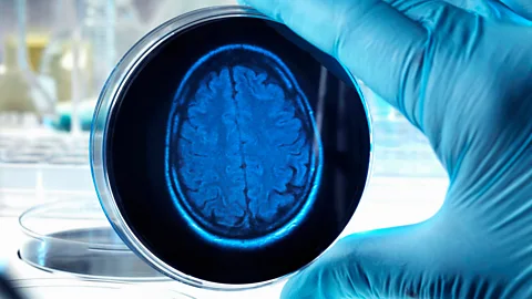 iStock The tiny brains cannot "think" because they do not have a body with which to help process information (Credit: iStock)