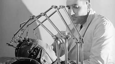 Getty Images Early attempts to test for signs of life included attaching pincers to nipples (Credit: Getty Images)