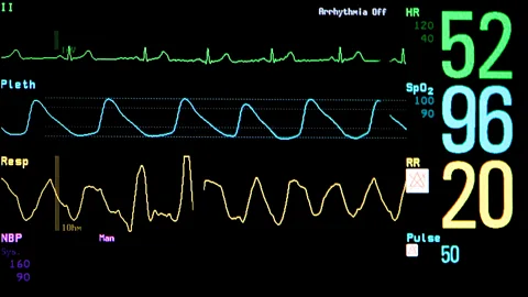 Science Photo Library Beating heart cadavers should not be confused with coma patients or those in a vegetative state (Credit: Science Photo Library)
