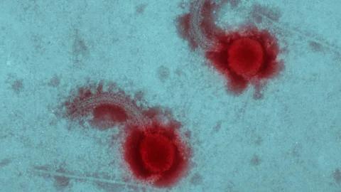 Alamy Bacteriophages target bacteria without harming the body's cells (Credit: Alamy)