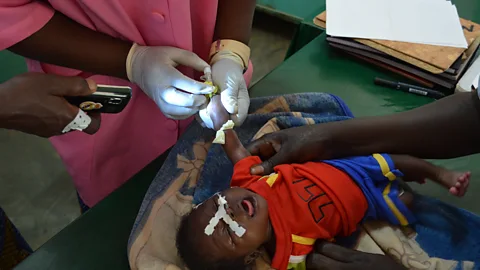 Emmanulle Bamongo To complete fiddly procedures, medics in the Central African Republic often turn to the lights on their mobile phones (Credit: Emmanulle Bamongo)