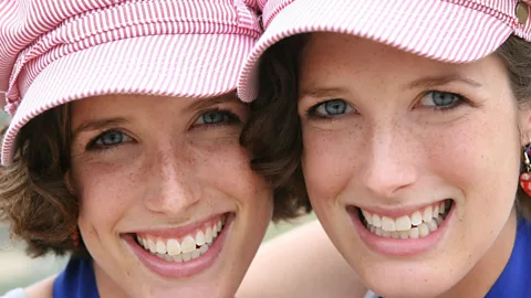 Getty Images Even twins can be identified through the tiny marks on the surface of the skin (Credit: Getty Images)