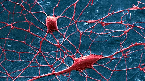 David McCarthy/Science Photo Library Pain is transmitted by nerve cells from the limbs to the spinal cord and from there to the brain (Credit: David McCarthy/Science Photo Library)
