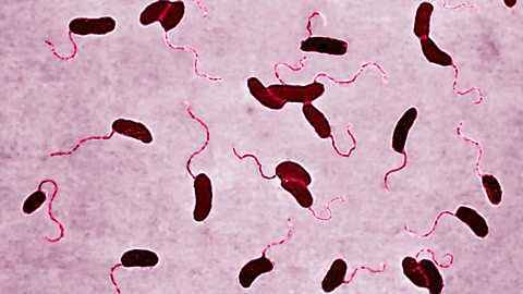 A picture of cholera bacteria. The bacteria have small broad bodies and long thin tails.