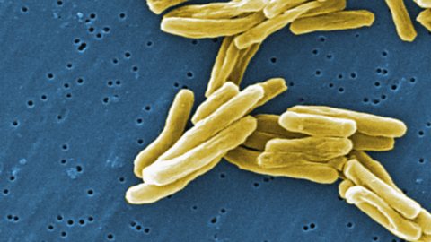 A picture of tuberculosis bacteria. The bacteria are tube shaped and do not have tails.