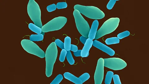 SPL Clostridium perfringens is associated with gastrointestinal disease (Credit: SPL)
